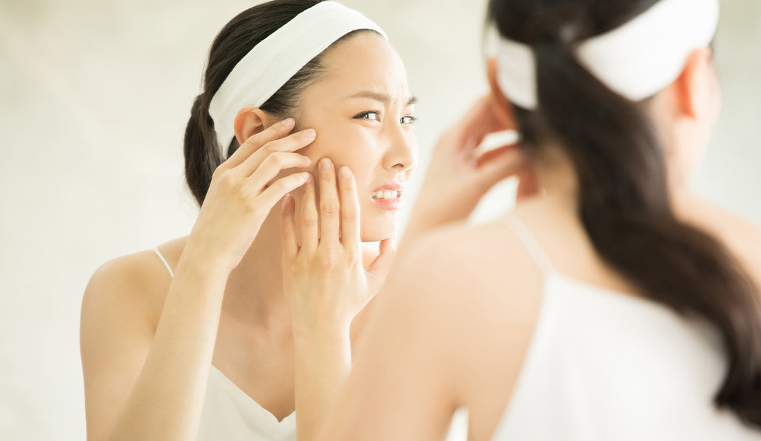 How to Tell if Your Acne Is Hormonal