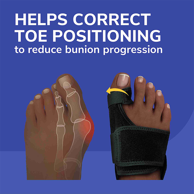 Dr. Scholl's Bunion Relief & Toe Corrrector