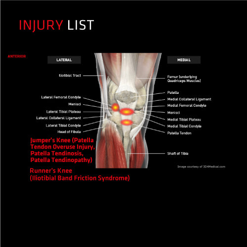 Thermoskin Dynamic Targeted Compression Knee Stabiliser (1 Unit)