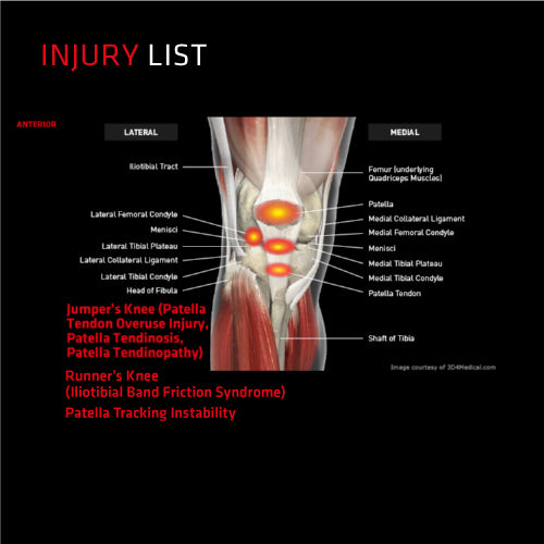 Thermoskin Sport Knee Adjustable with G7 Trioxon Flex Lining (1 Unit)