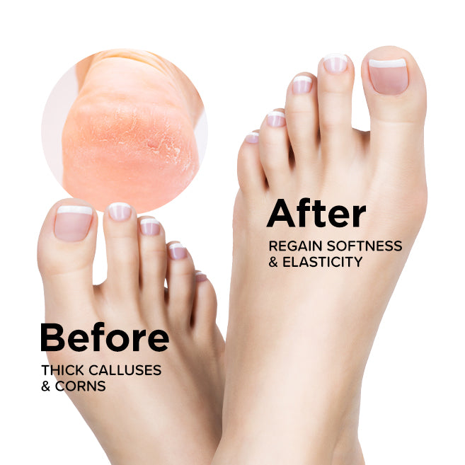 (NEW) Freeman Flirty Feet Cracked Heel Foot Treatment Neem Oil & Shea Butter 100ml